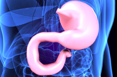 tumore gastrico
