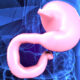 tumore gastrico