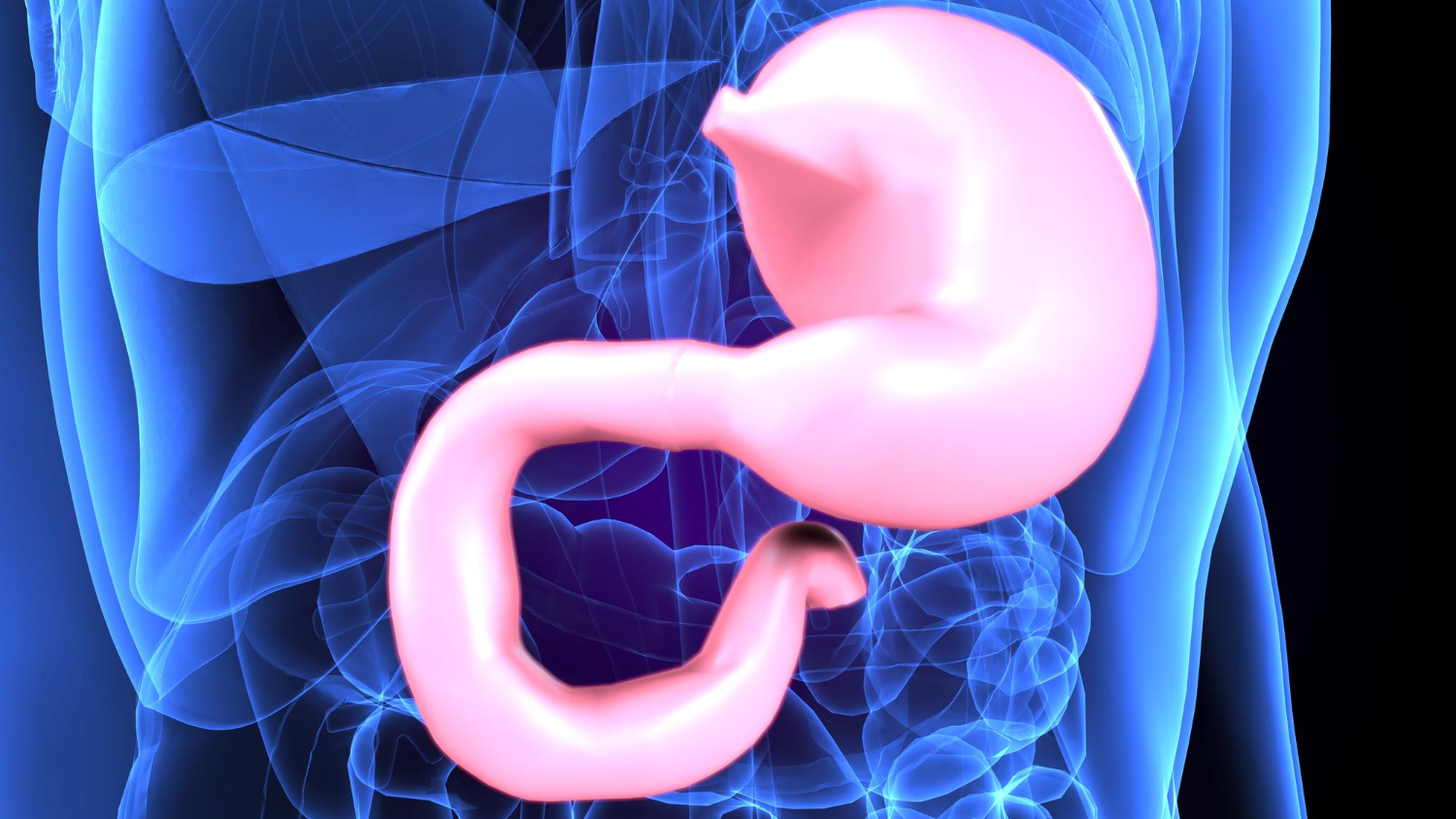 tumore gastrico
