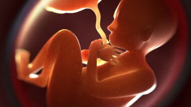 Asportazione cisti polmonare