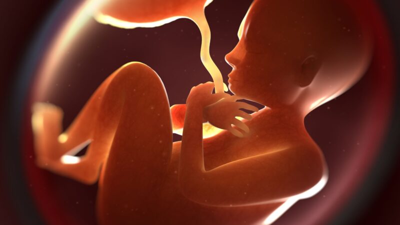 Asportazione cisti polmonare